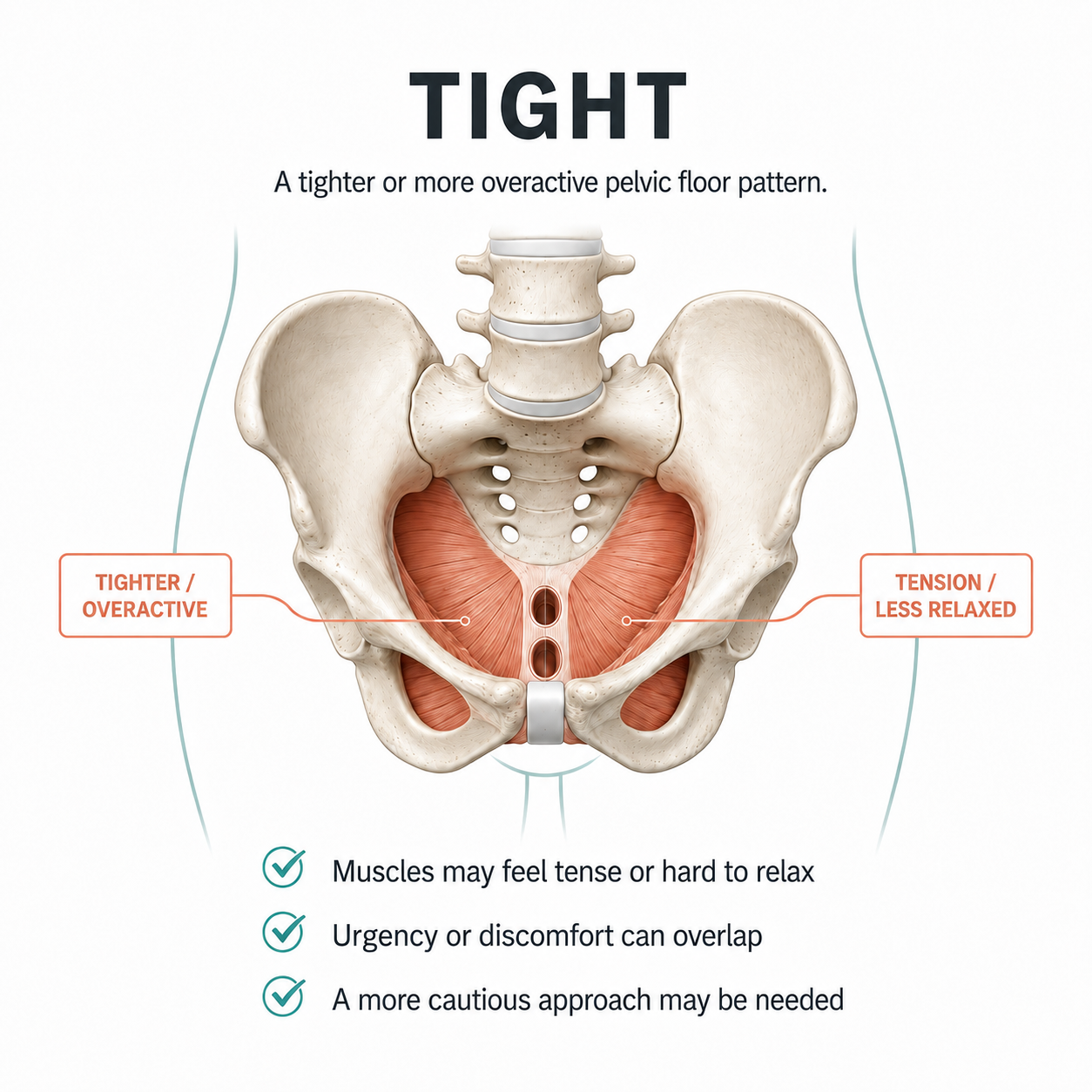 Tight pelvic floor pattern with muscles feeling tense or hard to relax and urgency or discomfort overlap