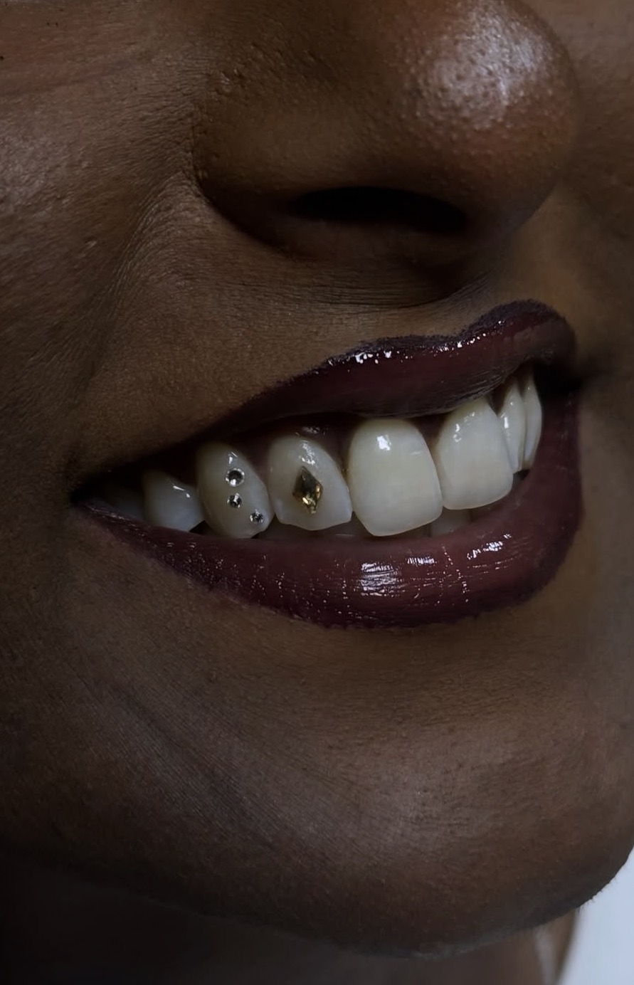 Tooth gem application with gold charm and crystal