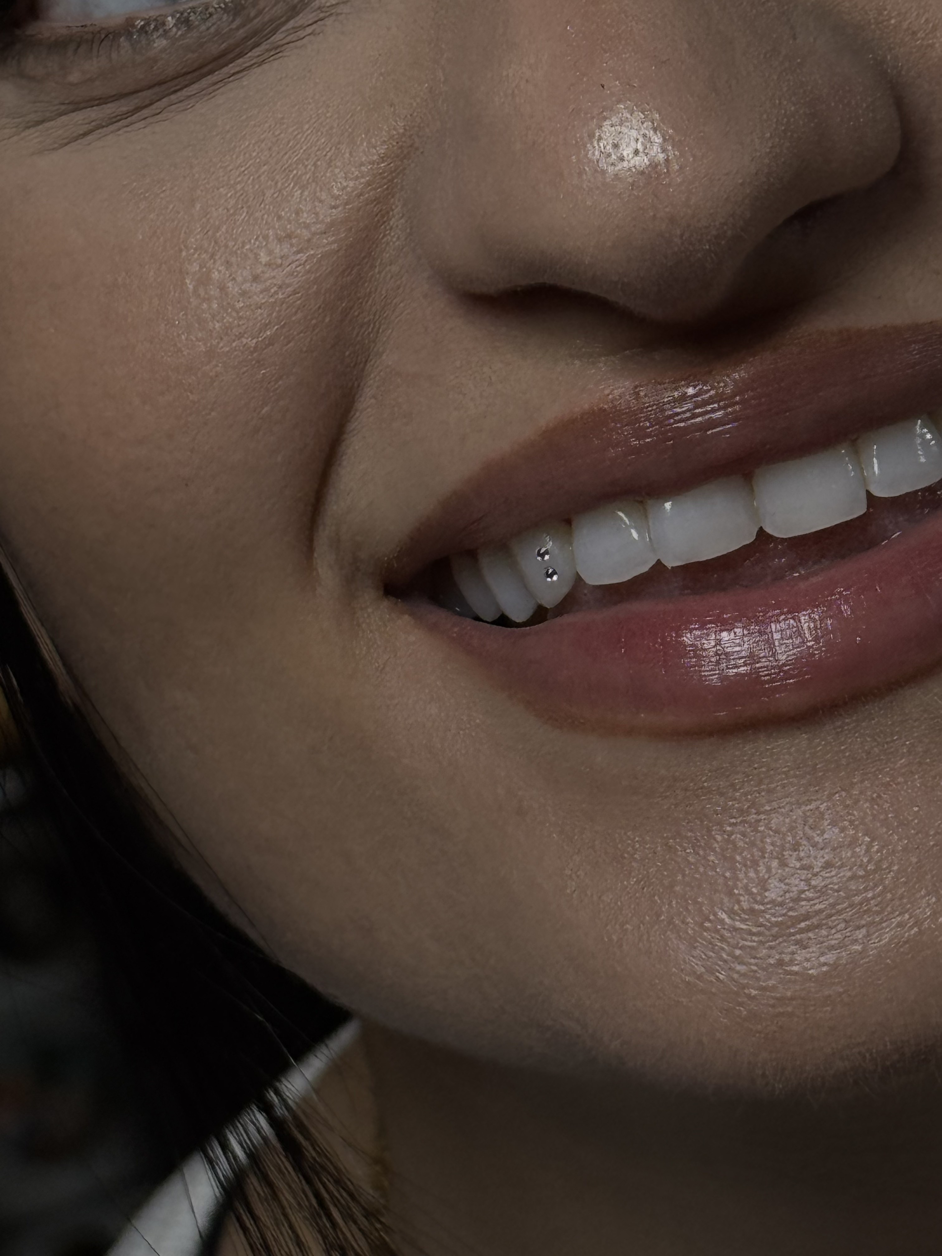 Tooth gem work