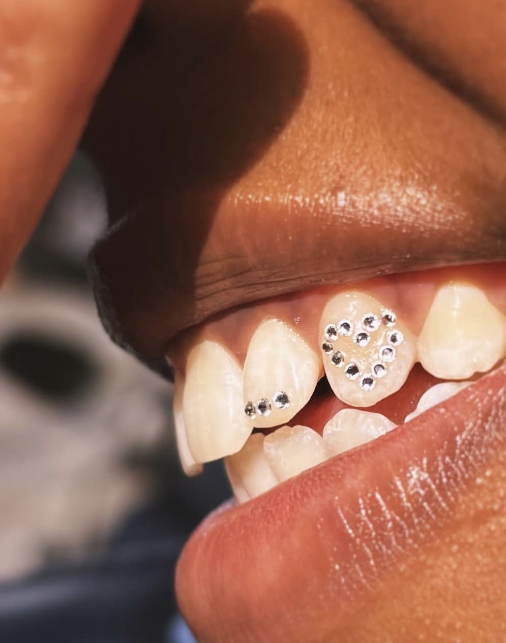 Smiley face tooth gem design