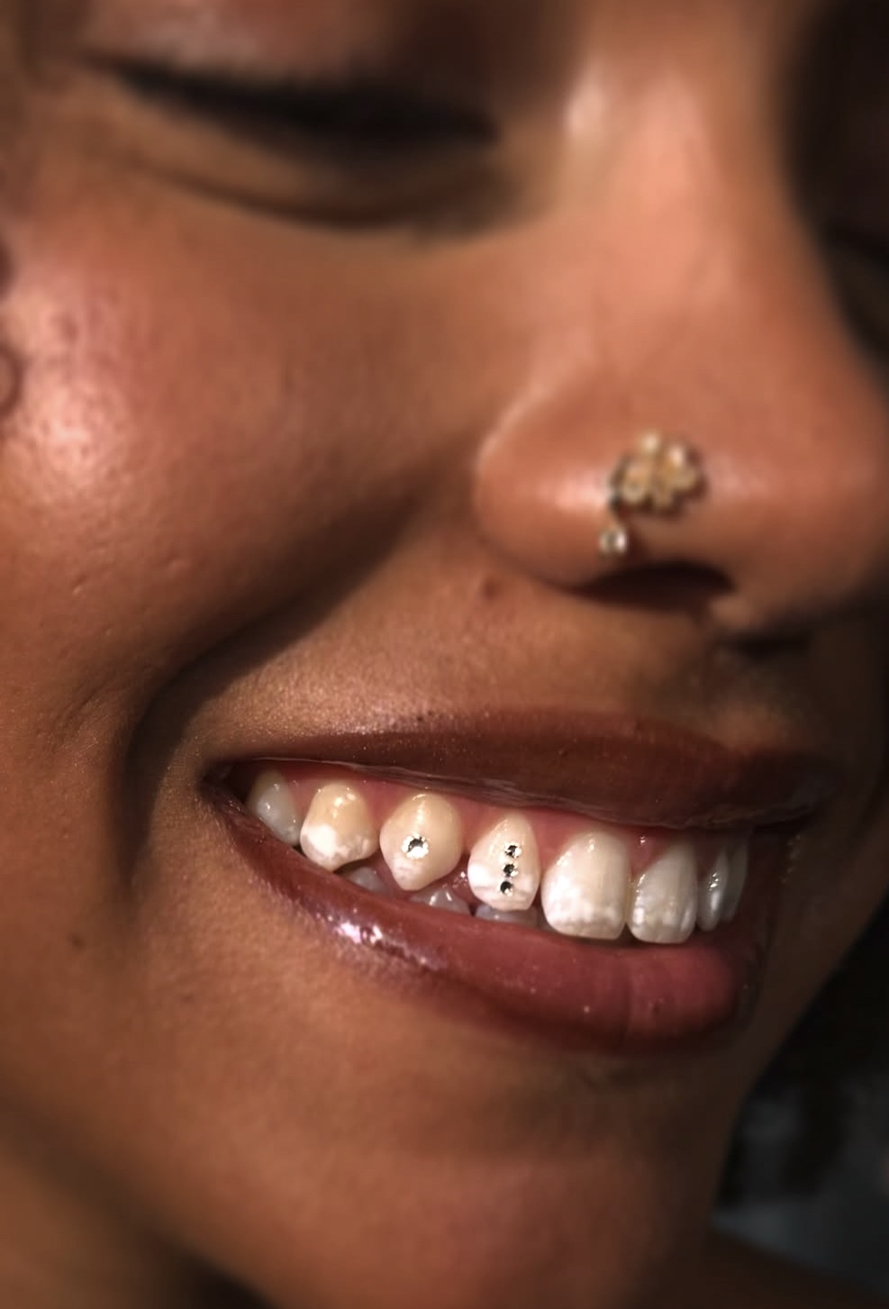 Tooth gem work