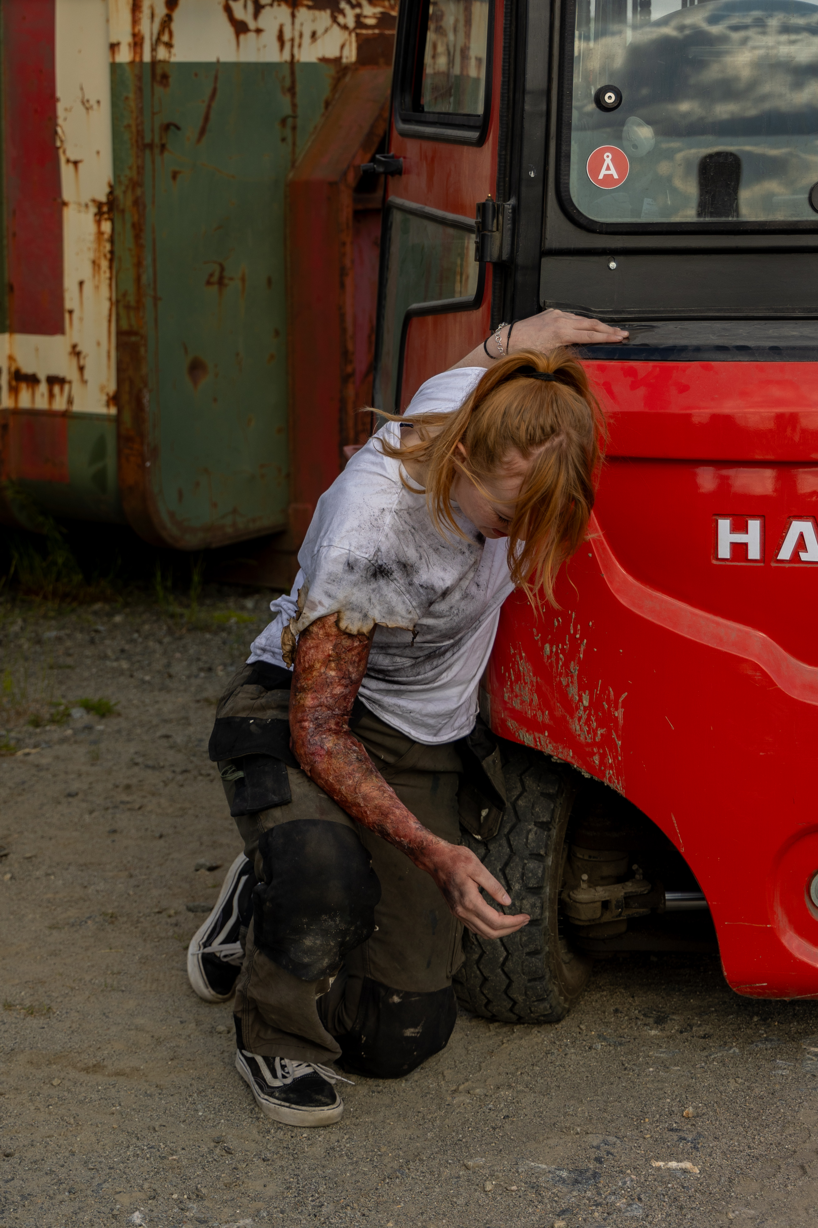 Brannskader: kjøling, vurdering og når du skal ringe 1-1-3